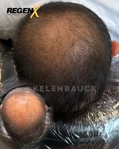 CABELO-PT-KELEN-BAUCK.webp