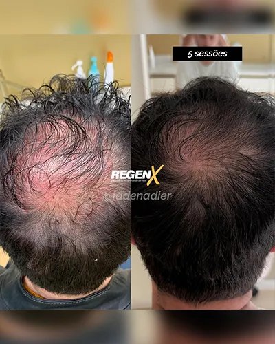 Jade-Nadier-CABELO-Ab-05-07-2025-PT.webp