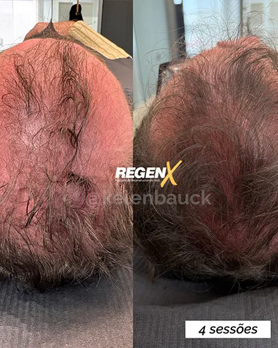 Kelen-Bauck-Cabelo-B-25-06-2025-PT.webp