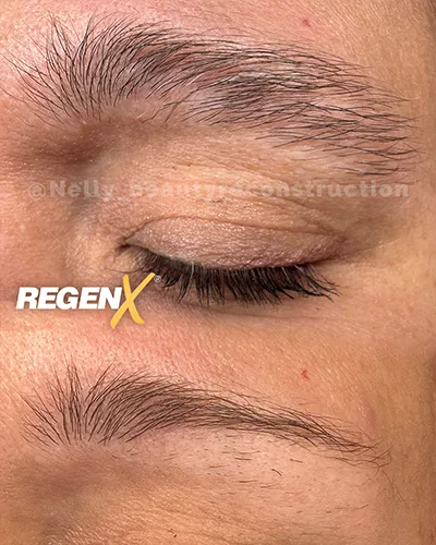 Sobrancelha-01-Nelly_beautyreconstruction-5-sessoes.webp